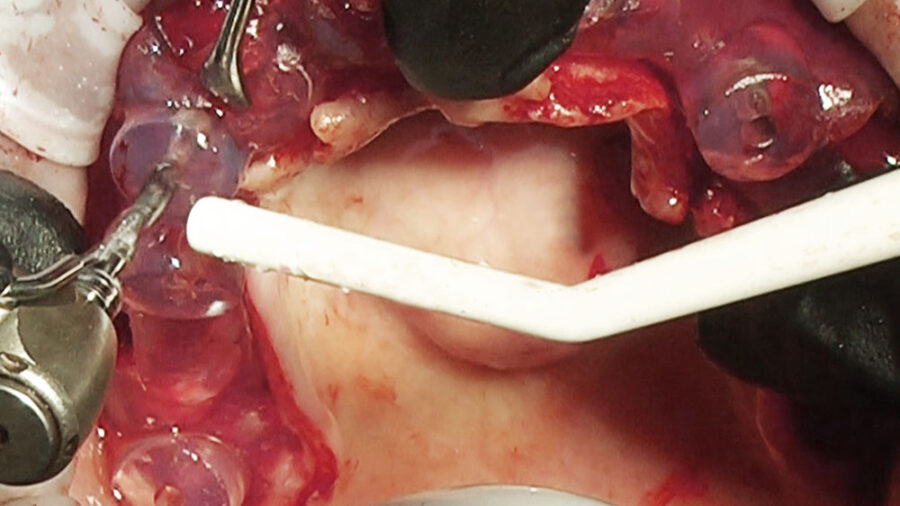 plan clin large singles clin ao4